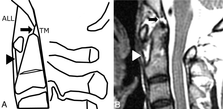 Fig 4.