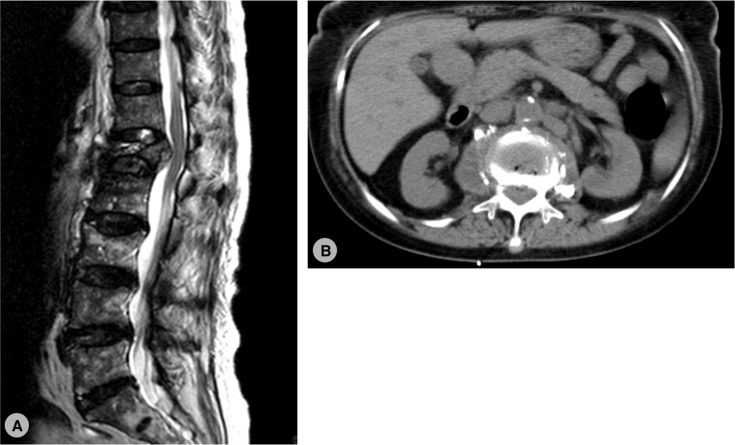 Fig. 2