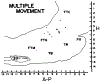 FIG. 11.