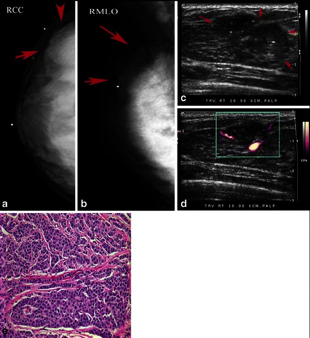 Fig. 14