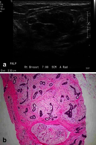 Fig. 11