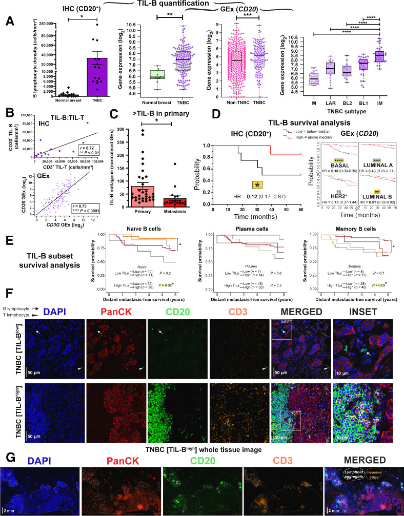 Figure 2. B lymphocyte infiltration and its positive prognostic value in TNBC. A, TIL-B quantification by IHC within normal breasts and TNBC (N = 15 each, Bart's IHC cohort), and by GEx (normal breast) vs. TNBC (N = 10 vs. 131, KCL GEx cohort); non-TNBC vs. TNBC (N = 515 vs. 123, TCGA GEx cohort); TNBC subtypes [mesenchymal (M), luminal androgen receptor (LAR), basal-like 1 and 2 (BL1 and 2), and immunomodulatory (IM; N = 122, KCL GEx cohort]. The Mann–Whitney test was used for statistical significance. B, TNBC TIL-B correlation with TIL-T by IHC (r = 0.72, Bart's IHC cohort) and by GEx (r = 0.73, KCL GEx cohort). Linear regression analysis was used to calculate correlation coefficients (r) and P values. C, B lymphocyte metagene NanoString GEx data comparing B lymphocytes in primary tumors with metastatic sites (N = 31 vs. 17; NanoString cohort). D, High (above median) TIL-B densities by IHC were associated with better overall survival in TNBC (N = 15; Bart's IHC cohort), and in the basal-like subtype by high CD20 GEx (N = 241; KM plotter cohort; log rank test used to assess statistical significance). E, Kaplan–Meier survival curves display DMFS for naïve B cells, plasma cells, and memory B cells in TNBC (KCL GEx cohort) using CIBERSORT (20). Data were divided into four groups based on B lymphocyte subset and TIL levels stratified by semiquantitative TIL classification. Statistical significance was assessed using univariate Cox proportional hazards regression models. F, Representative IHC/IF images (Bart's IHC cohort) depicting nucleated cells (DAPI), epithelial cells (PanCK), B lymphocytes (CD20), and T lymphocytes (CD3) within TNBC TIL-Blow and TIL-Bhigh lesions. Scale bar, 50 μm. G, Representative TNBC (TIL-Bhigh) images highlighting numerous lymphoid aggregates (within white dash lines) consisting of B lymphocytes assembled adjacent to a T lymphocyte zone. Brown dash lines indicate carcinoma edge. Scale bar, 2 mm. *, P < 0.05; **, P < 0.01; ***, P < 0.001; ****, P < 0.0001.