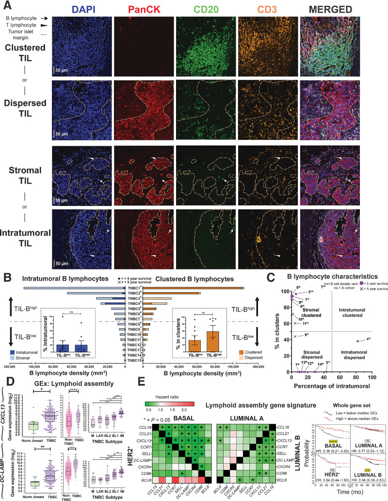 Figure 3. Occurrence of B lymphocytes in stromal clusters. A, Representative IHC/IF images (Bart's IHC cohort) highlighting key TIL characteristics: clustered TIL versus dispersed TIL and stromal TIL (outside tumor nests) versus intratumoral TIL (within tumor nests). Scale bar, 50 μm. B, Quantitative assessment of TIL-B spatial and structural characteristics within TNBC (N = 15; left) intratumoral versus stromal; clustered versus dispersed (right). Patients ranked according to CD20+ TIL-B density (TNBC1 = highest), and overall survival data are indicated. Inset, patient samples split at median density into high and low TIL-B groups and the percentage of intratumoral (left) or clustered (right) B lymphocytes were analyzed. Statistical significance was determined using the Student t test. C, Characterization of TNBC TIL-B profile as stromal clustered, intratumoral clustered, stromal dispersed, or intratumoral dispersed. Overall survival data are indicated. D, GEx data for lymphoid assembly marker genes CXCL13 and DC-LAMP: normal breast versus TNBC (N = 10 vs. 131, KCL GEx cohort; left); non-TNBC vs. TNBC (N = 515 vs. 123, TCGA GEx cohort; middle); TNBC subtypes (N = 122, KCL GEx cohort; right). E, Survival analysis in KM Plotter of determined ER−HER2−/basal surrogate, HER2+, luminal A, and luminal B subtype KM plotter surrogate subgroups (KM plotter cohort; ref. 19). These indicate that expression of lymphoid cell assembly genes carries positive prognostic value in TNBC/basal-like and luminal B subtypes. Individual genes were evaluated in combination with each other gene (left) and gene set as a whole (right). ns, nonsignificant; *, P < 0.05; **, P < 0.01; ****, P < 0.0001.