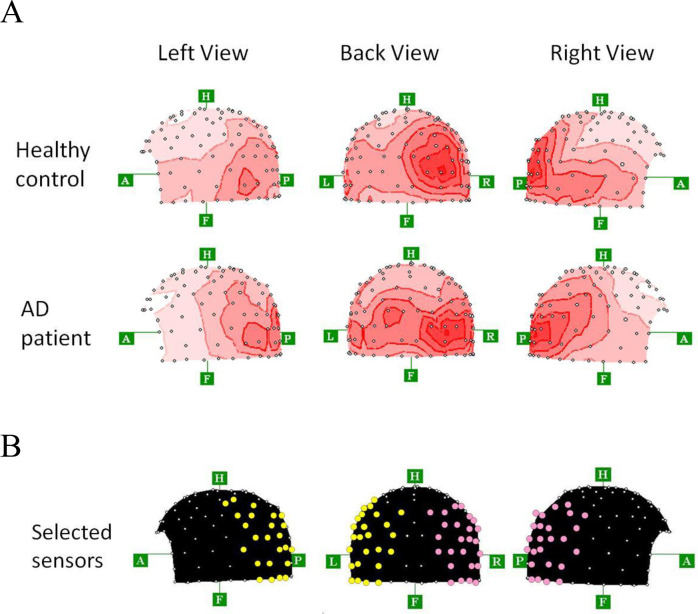 Fig 3