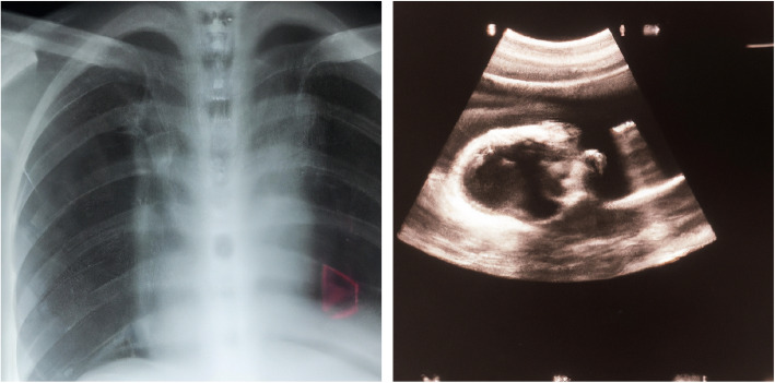 Fig. 17