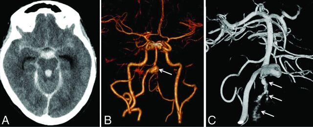 Fig 1.