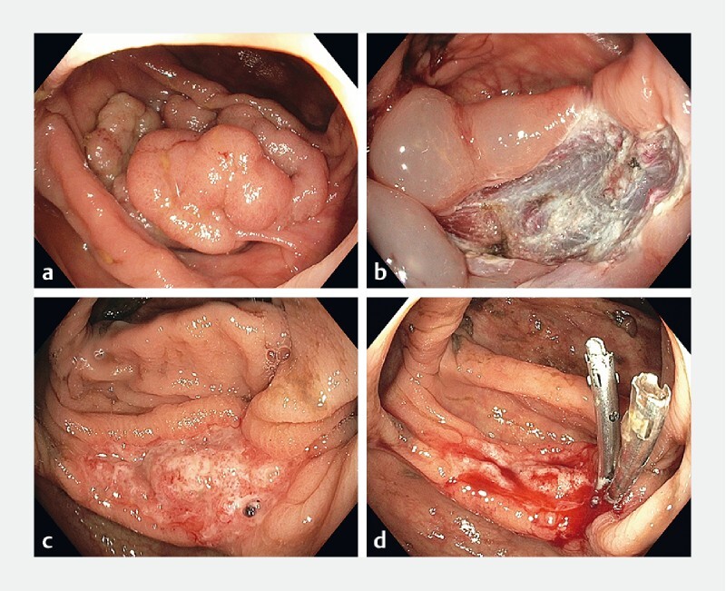 Fig. 2 a