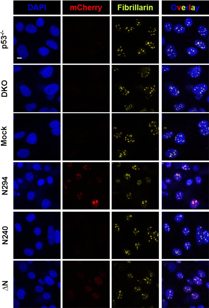 Figure 12—figure supplement 1.