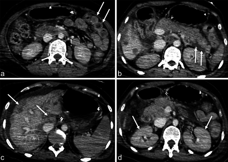 Fig. 4