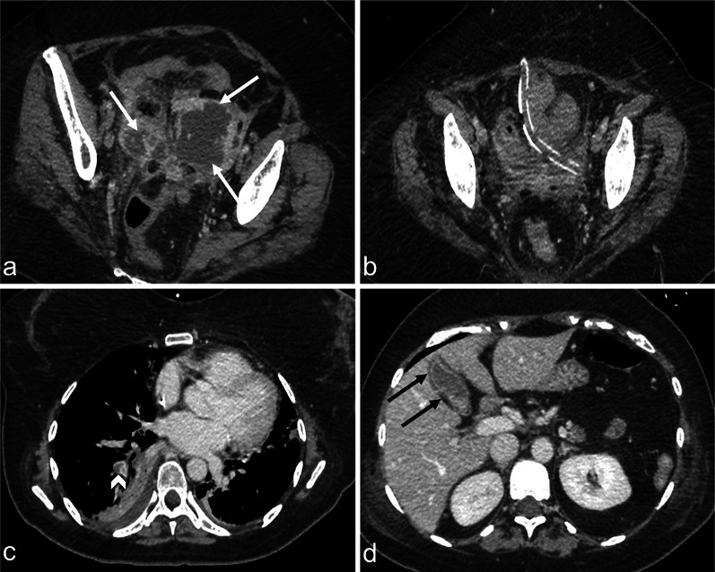 Fig. 5