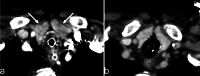 Fig. 11
