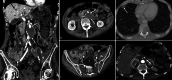 Fig. 9