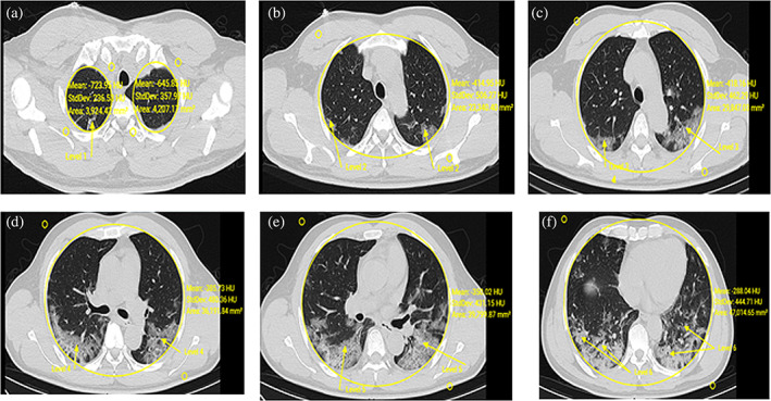 FIGURE 9