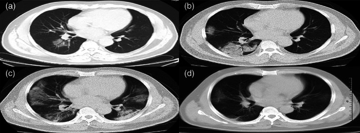 FIGURE 2