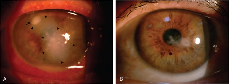 FIGURE 3