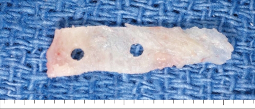 Fig. 9