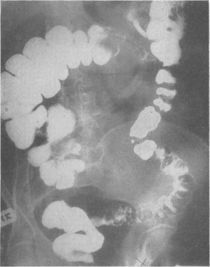 FIG. 11