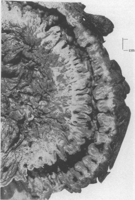 FIG. 7