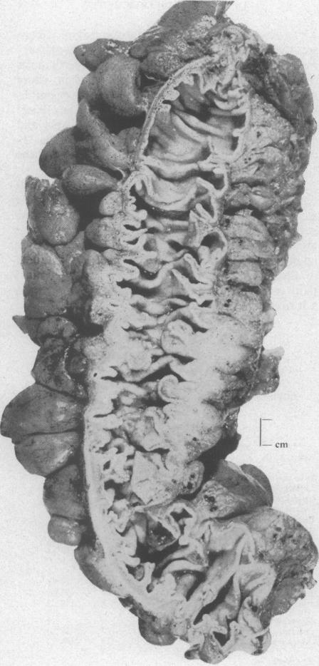 FIG. 8