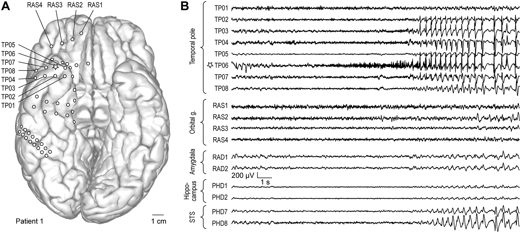 Figure 2: