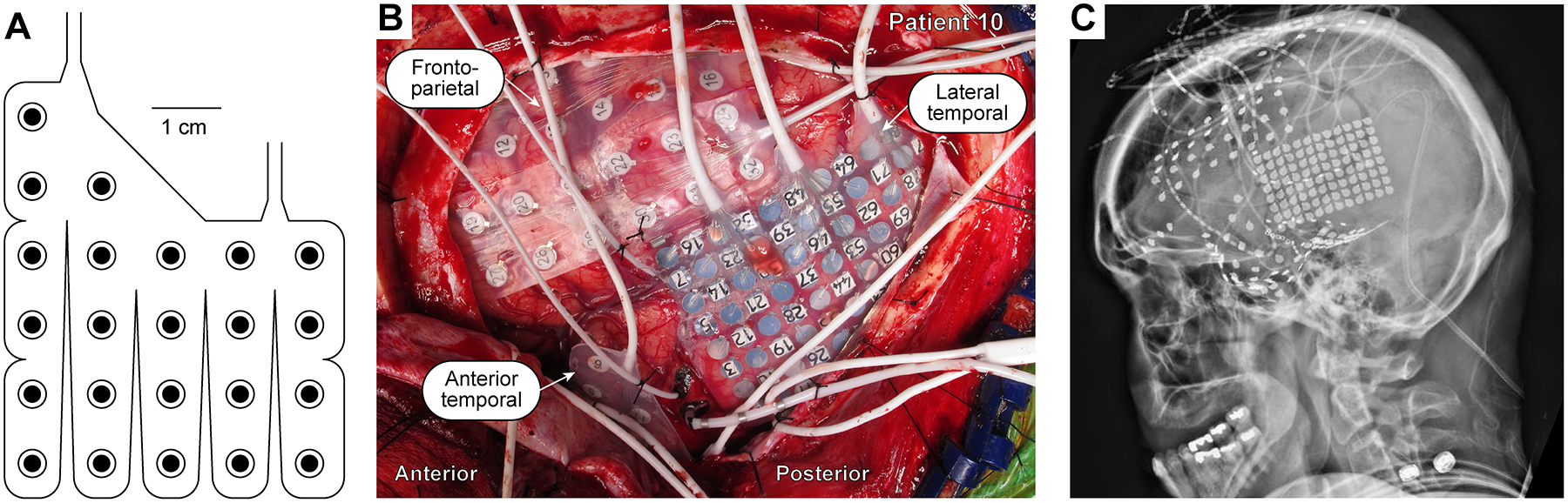 Figure 1: