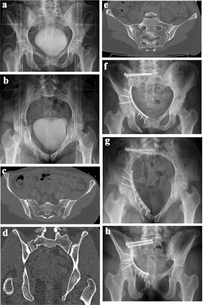 Fig. 4