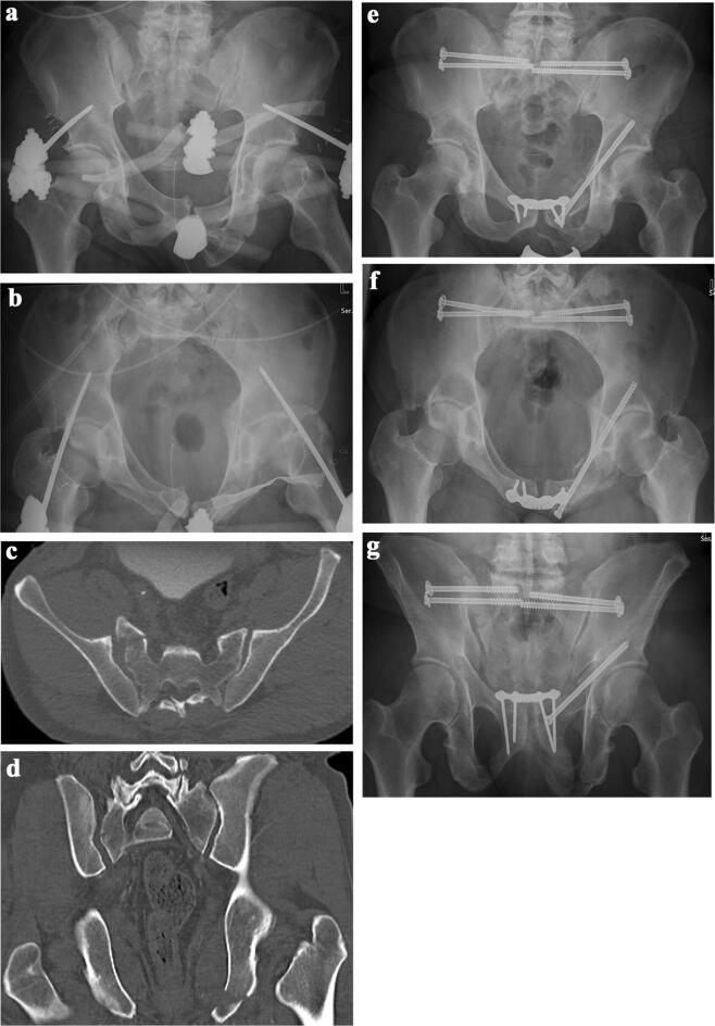 Fig. 2