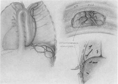 Fig. 12.