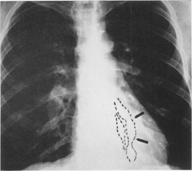 Fig. 7.