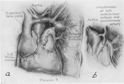 Fig. 11.