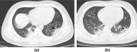 Figure 5