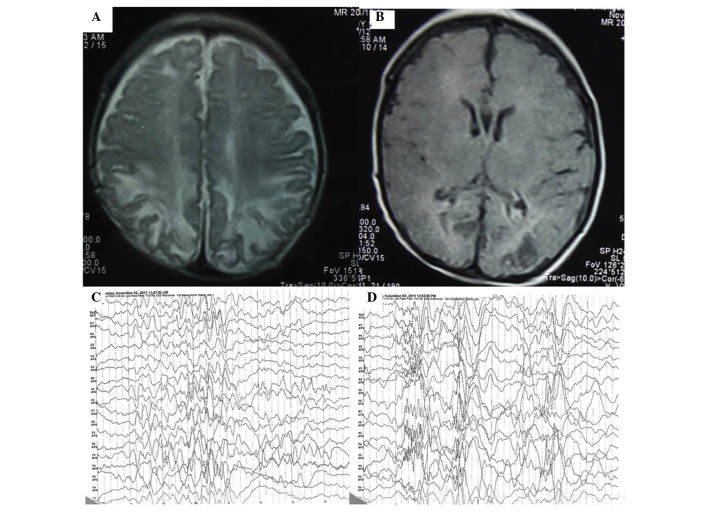 Figure 2.