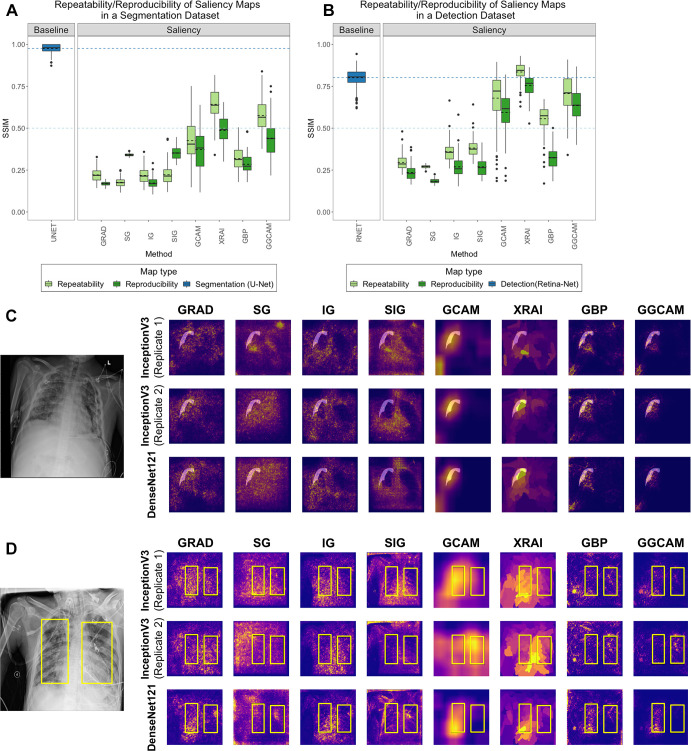 Comparison of repeatability and reproducibility scores for all saliency methods for (A) SIIM-ACR Pneumothorax Segmentation dataset and (B) RSNA Pneumonia Detection Challenge dataset. Each box plot represents the distribution of scores across the test datasets for each saliency map, with a solid line denoting the median and a dashed line denoting the mean. Results are compared with a low baseline of SSIM = 0.5 (light blue dashed line) and high baseline using U-Net or RetinaNet (dark blue box plot and dashed line). Two examples of repeatability (InceptionV3 replicates 1 and 2) and reproducibility (InceptionV3 and DenseNet-121) for the (C) SIIM-ACR pneumothorax dataset with transparent segmentations and (D) RSNA pneumonia dataset with yellow bounding boxes. The first two rows of (C) and (D) are saliency maps generated from two separately trained InceptionV3 models (replicates 1 and 2) to demonstrate repeatability, and the last row are saliency maps generated by DenseNet-121 to demonstrate reproducibility. GBP = guided backpropagation, GCAM = gradient-weighted class activation mapping, GGCAM = guided GCAM, GRAD = gradient explanation, IG = integrated gradients, RSNA = Radiological Society of North America, SG = Smoothgrad, SIG = smooth IG, SIIM = Society for Imaging Informatics in Medicine, SSIM = structural similarity index measure.