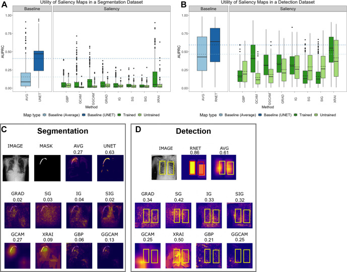 (A) Test set segmentation AUPRC scores for SIIM-ACR Pneumothorax Segmentation dataset and (B) test set bounding box detection AUPRC scores for RSNA Pneumonia Detection Challenge dataset. Each box plot represents the distribution of scores across the test datasets for each saliency map, with a solid line denoting the median and a dashed line denoting the mean. Results are compared with a low baseline using the average segmentation or bounding box of the training and validation sets (light blue) and high baseline using U-Net or RetinaNet (dark blue). (C) Example saliency maps on SIIM-ACR pneumothorax dataset with corresponding AUPRC scores and (D) on RSNA pneumonia dataset with corresponding utility scores. “AVG” refers to using the average of all ground-truth masks (for pneumothorax) or bounding boxes (for pneumonia) across the training and validation datasets; “UNET” refers to using the U-Net trained on a segmentation task for localization of pneumothorax; “RNET” refers to using RetinaNet to generate bounding boxes for localizing pneumonia with bounding boxes. ACR = American College of Radiology, AUPRC = area under the precision-recall curve, GBP = guided backpropagation, GCAM = gradient-weighted class activation mapping, GGCAM = guided GCAM, GRAD = gradient explanation, IG = integrated gradients, RSNA = Radiological Society of North America, SG = Smoothgrad, SIG = smooth IG, SIIM = Society for Imaging Informatics in Medicine.