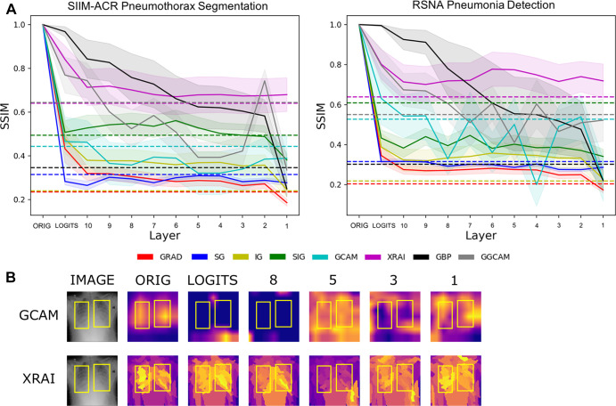 (A) Structural similarity index measures (SSIMs) under cascading randomization of modules on InceptionV3 for the SIIM-ACR Pneumothorax Segmentation dataset and RSNA Pneumonia Detection Challenge dataset. Note that the colored dotted lines correspond to the randomization baseline for each saliency map, which were generated by the average SSIMs of 50 randomly chosen pairs of saliency maps pertaining to the fully trained model; a saliency model successfully reaches degradation if it goes below its corresponding randomization baseline. (B) Example image from RSNA pneumonia detection dataset to visualize saliency map degradation from cascading randomization. “Logits” refers to the logit layer (final layer) of the InceptionV3 model, and layer blocks 1 through 10 refer to blocks mixed 1 through mixed 10 in the original InceptionV3 architecture. ACR = American College of Radiology, GBP = guided backpropagation, GCAM = gradient-weighted class activation mapping, GGCAM = guided GCAM, GRAD = gradient explanation, IG = integrated gradients, Orig = original, RSNA = Radiological Society of North America, SG = Smoothgrad, SIG = smooth IG, SIIM = Society for Imaging Informatics in Medicine.