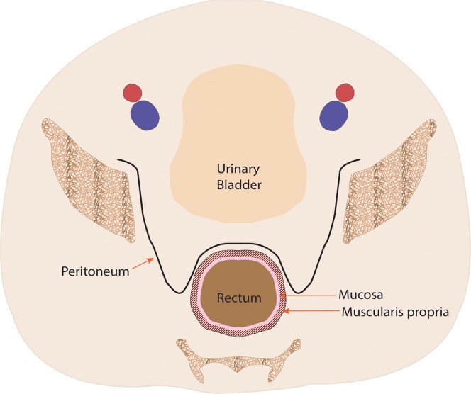 Figure 1b.