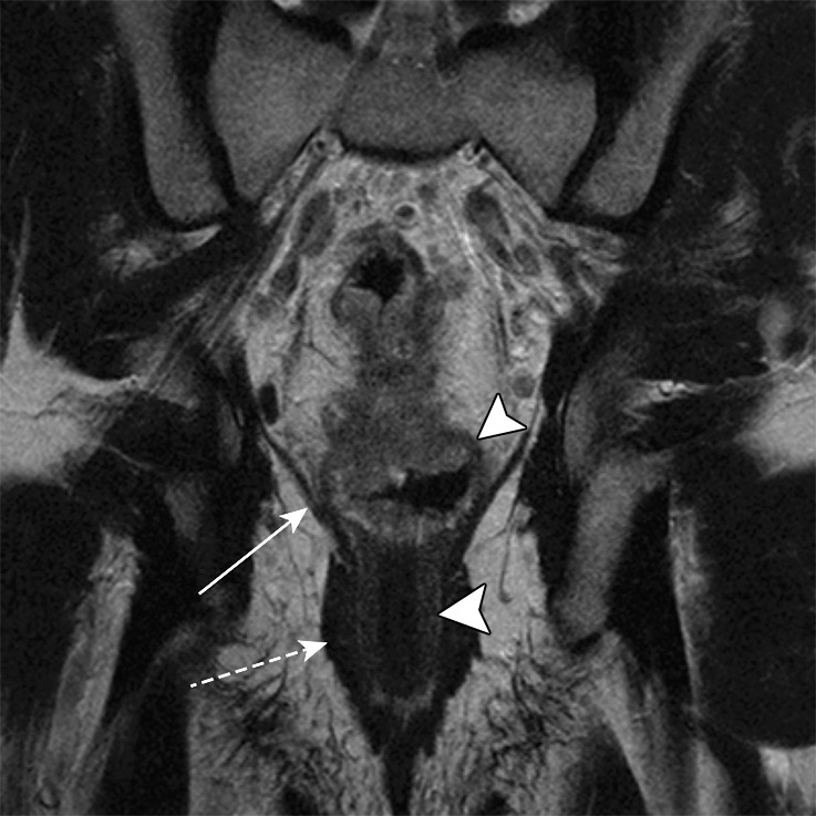 Figure 3c.