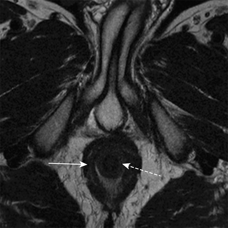 Figure 3b.