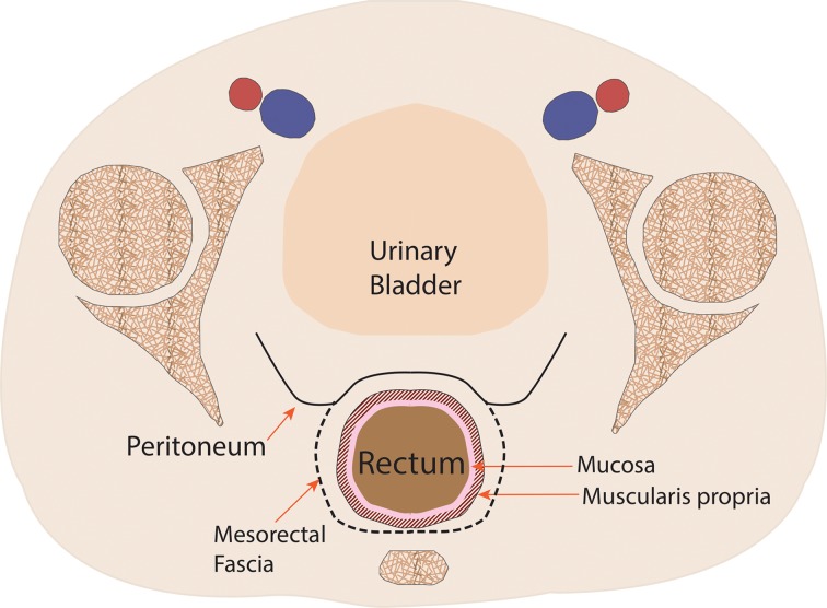 Figure 1c.