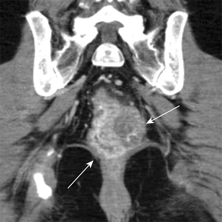 Figure 12a.