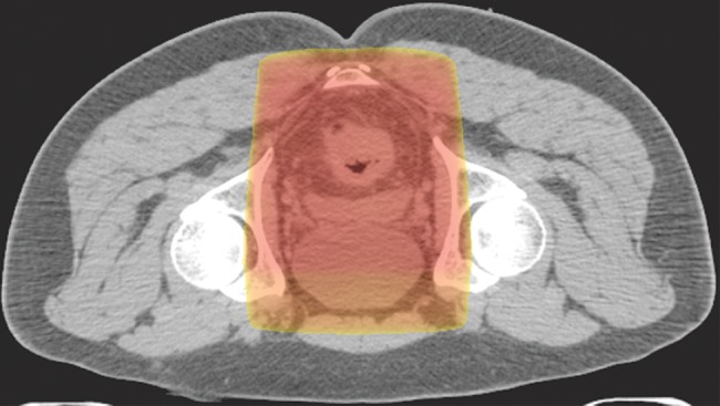 Figure 13b.