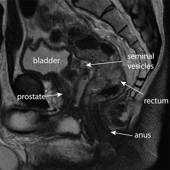 Figure 2d.