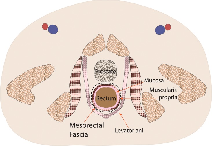 Figure 1d.