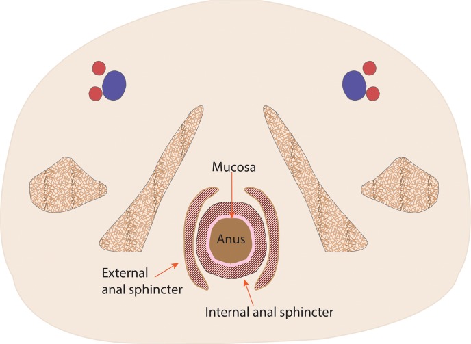 Figure 1e.