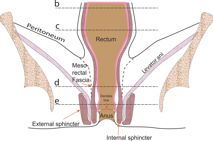 Figure 1a.