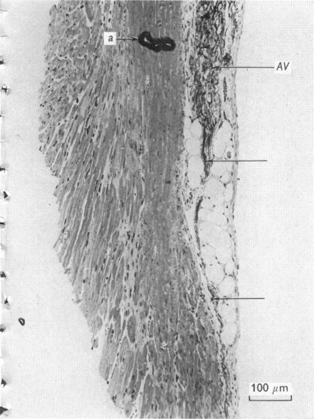 Fig. 14