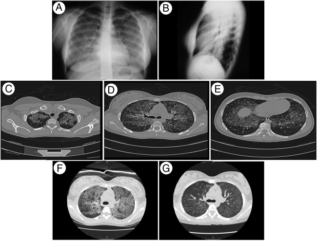 Figure 1