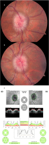 Fig. 2