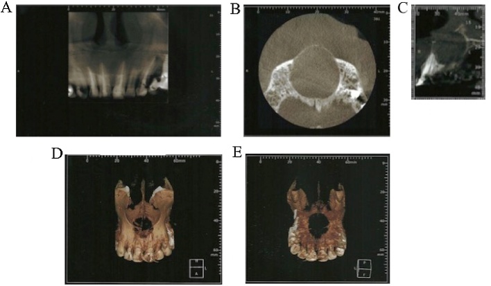 Fig. 1