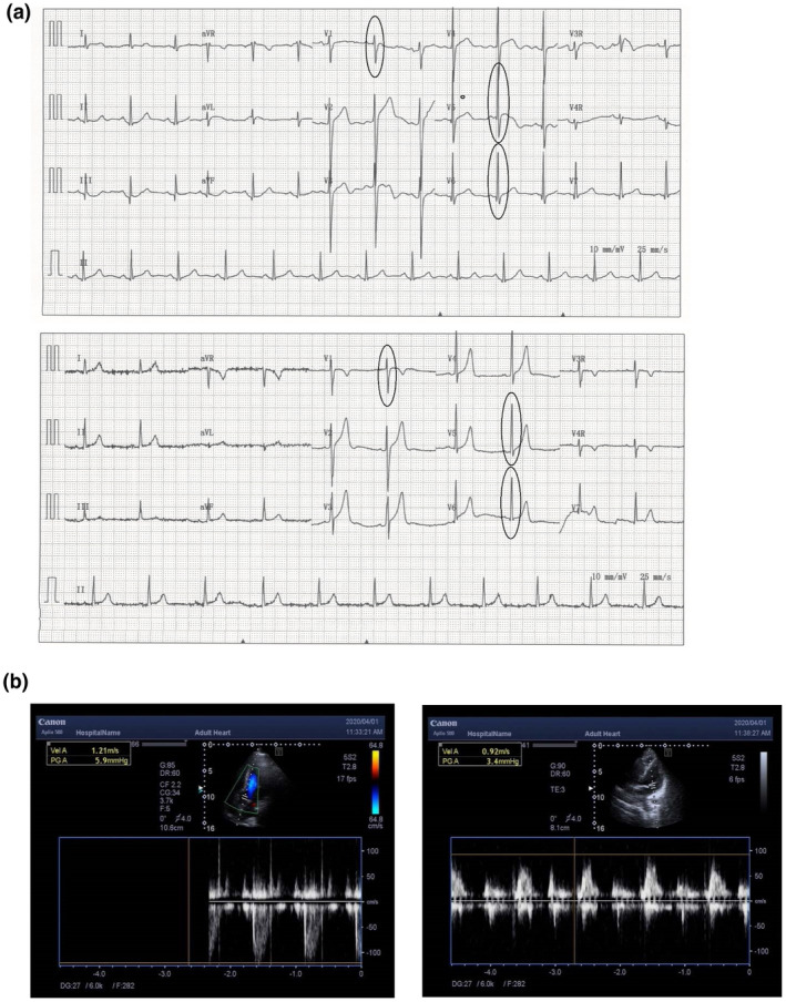 FIGURE 3